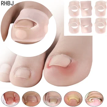 RHBJ ציפורן תיקון מגן אצבע מפריד Paronychia טיפול פדיקור תיקון הטיפול ברגל כלי מיישר קליפ סד